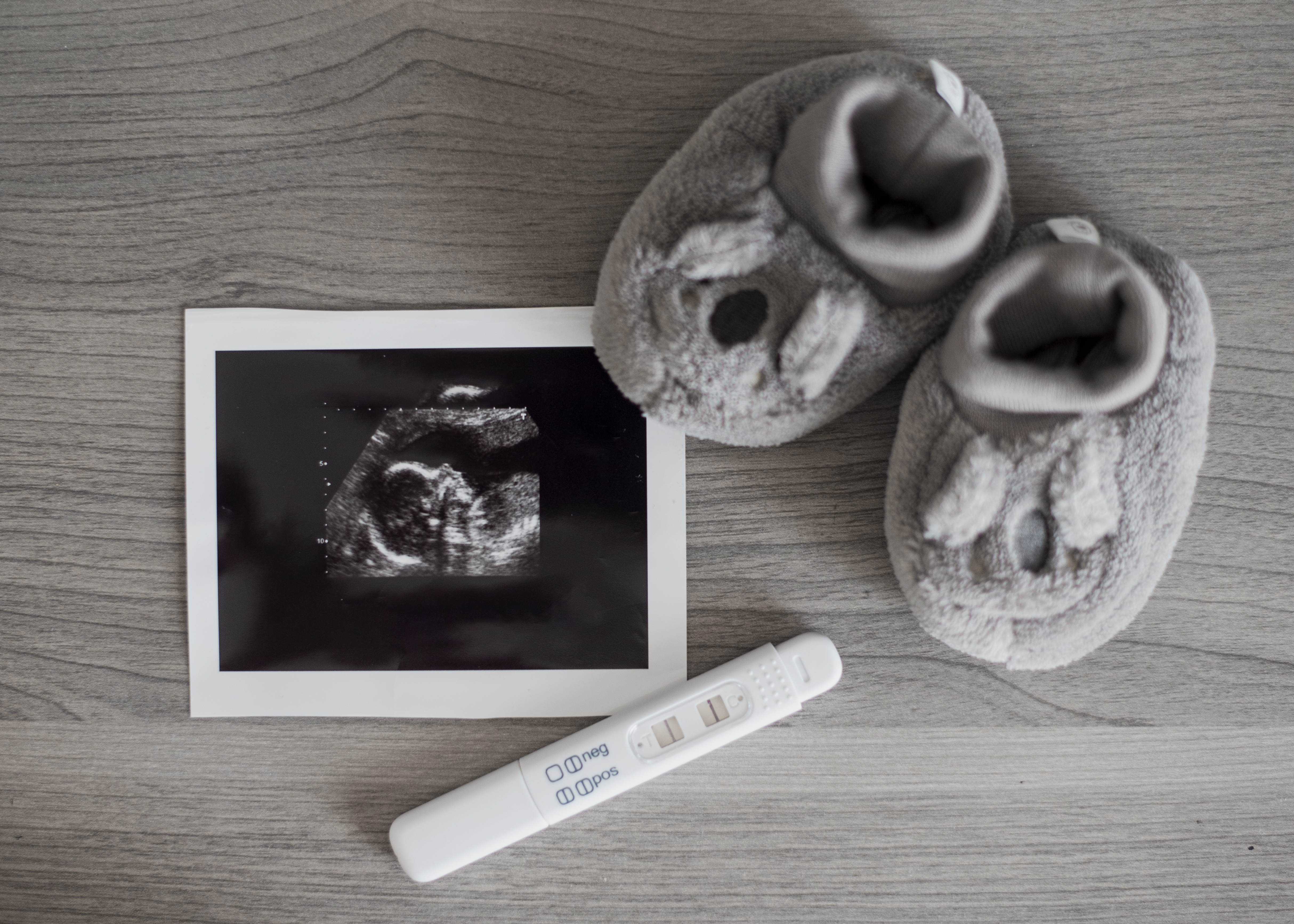 cute-little-shoes-x-ray-photo